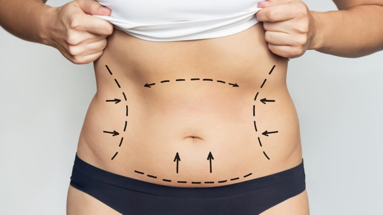 Lipo HD